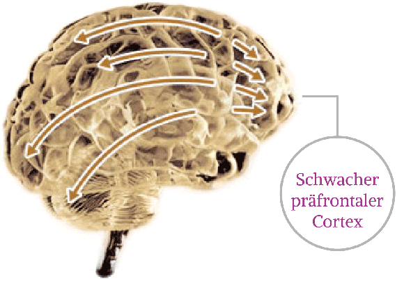 Gehirn unter Stress: Schwacher präfrontaler Cortex